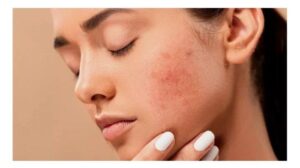 leebeaute - skin barrier